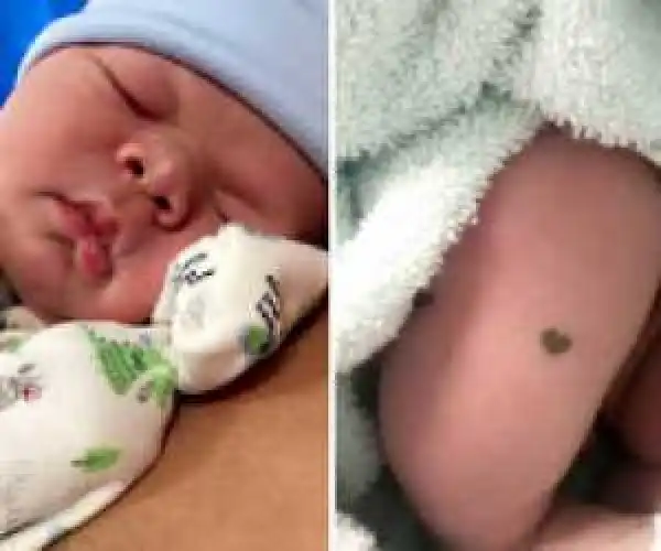 Photo: Baby Born with Adorable Heart-Shaped Birthmark on His Leg